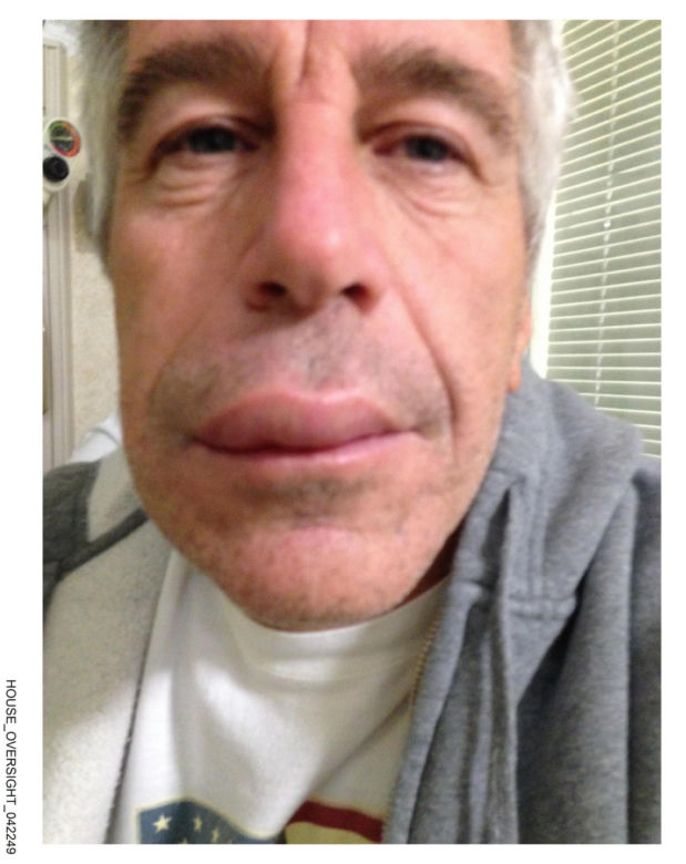Epstein