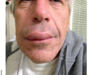 Epstein