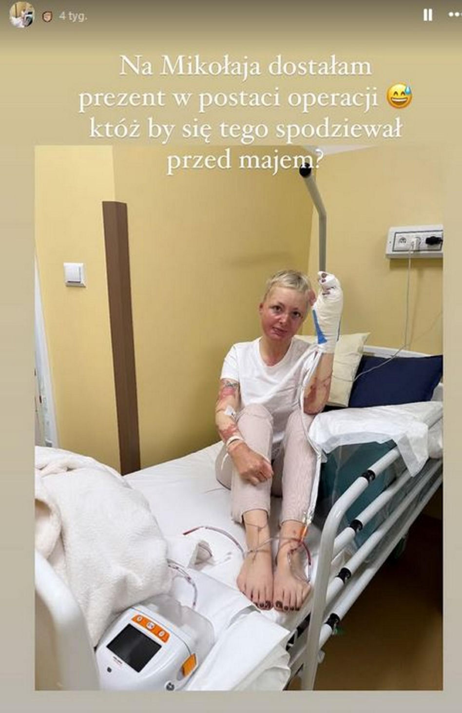Maja Kuczyńska przeżyła piekło. Całe ciało w oparzeniach