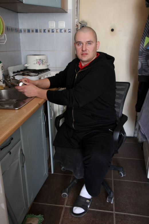 Przez urzędników stracę nogę