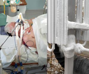 Alarm w szpitalu Południowym. Awaria instalacji. Jadą butle z tlenem