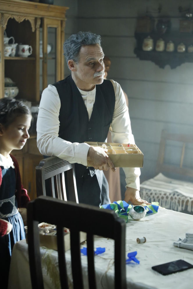 Jan Wieczorkowski przed przeszczepem włosów