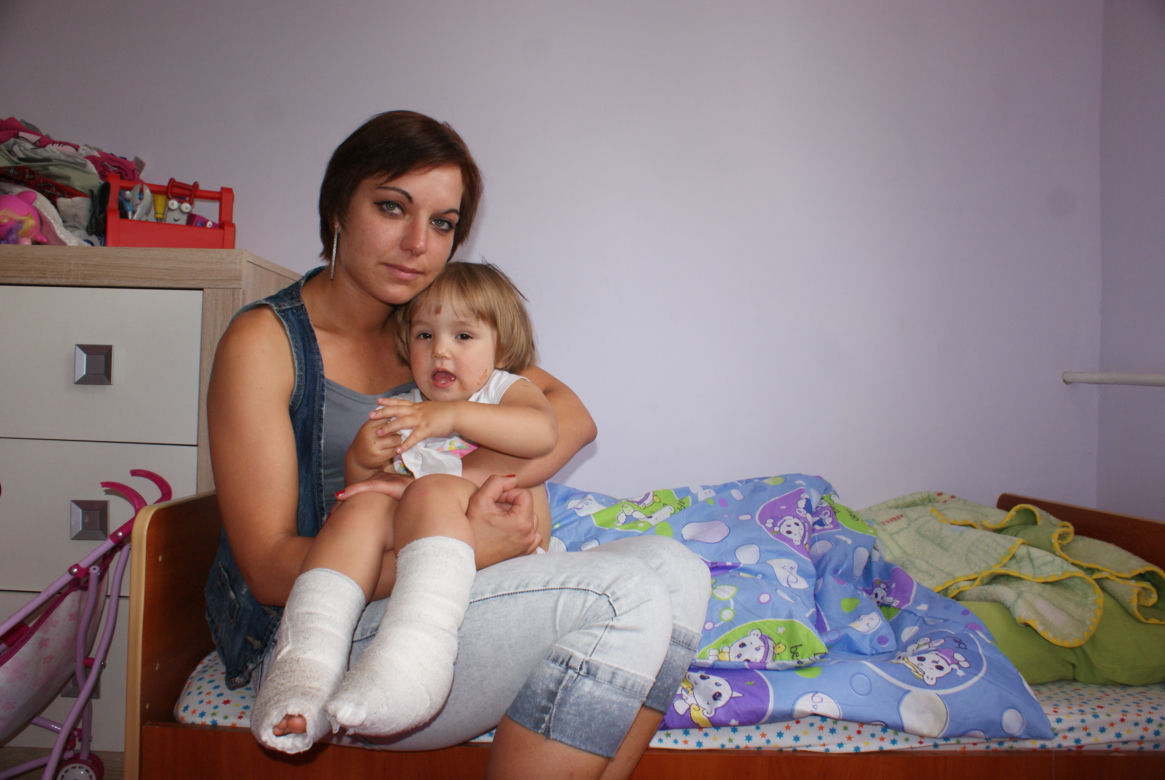 2-latka weszła na rozgrzany właz i poparzyła swoje stopki