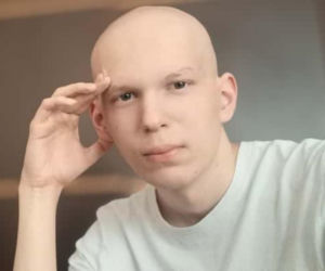 17-letni Michał walczy z nowotworem kości. Jego słowa poruszają wszystkich. Ja nie chcę umierać