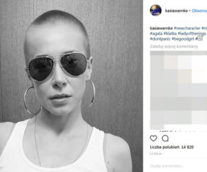Gwiazdy bez włosów