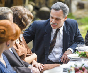 Jan Wieczorkowski przed przeszczepem włosów