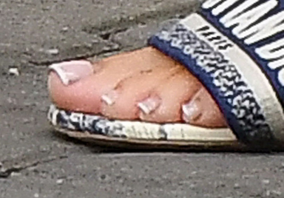 Stopy Małgosi