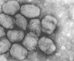 Epidemia ospy w Meksyku