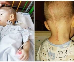 Zdążyć z guzem przed koronawirusem. Filip potrzebuje ponad 5 mln na leczenie