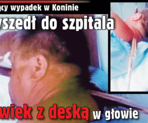 To prawdziwy CUD, że on żyje! Do szpitala o własnych siłach przyszedł człowiek z deską w głowie