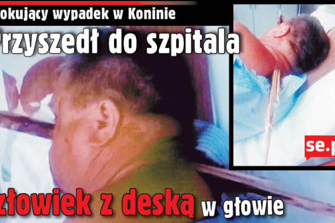 To prawdziwy CUD, że on żyje! Do szpitala o własnych siłach przyszedł człowiek z deską w głowie
