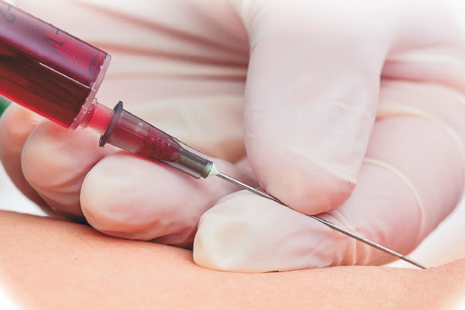 SZPICZAK PLAZMOCYTOWY może być chorobą przewlekłą