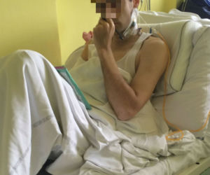 Przez gips zgniła mi ręka